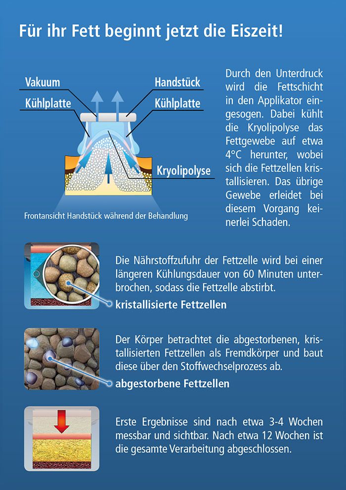 Kryolipolyse-Information