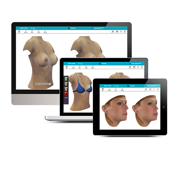 Infrarot-3D-Kamera zur professionellen 3D-Simulation